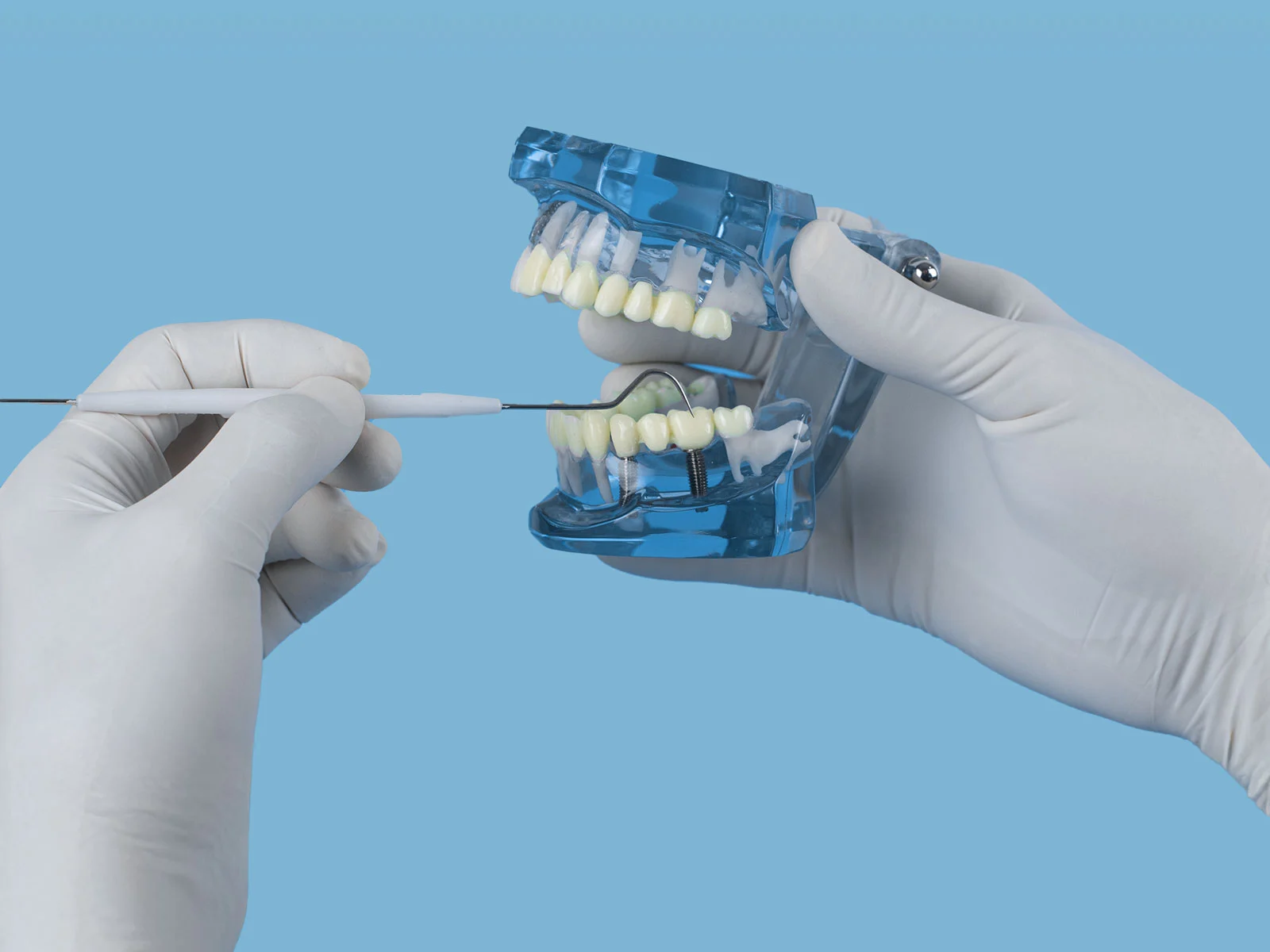 Protesi Dentarie Busto Arsizio